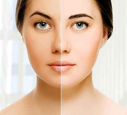 skin whitening treatment in lahore